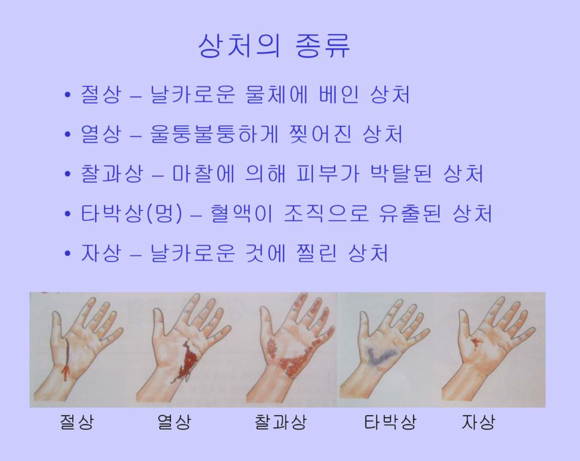 상처의 종류별 특징과 치료법, 이것만 알면 끝!