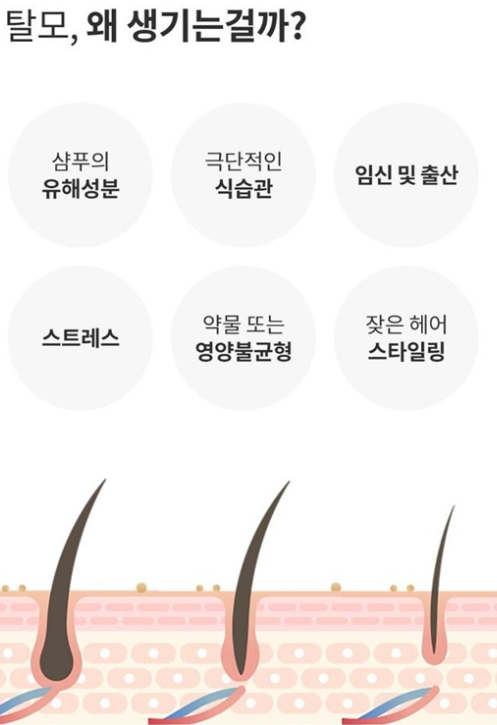 탈모