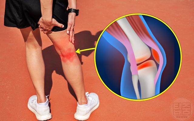 무릎 뒤 통증 원인 정형외과