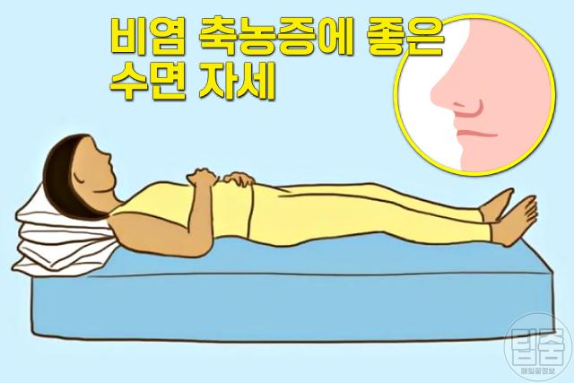 축농증에 좋은 수면 자세,팁줌