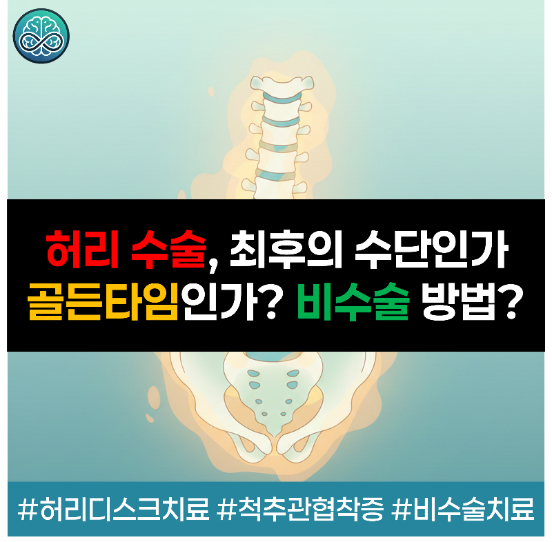 탈출된 허리 디스크가 신경을 압박하는 구조와 마미증후군 등 수술이 필요한 응급 상황, 그리고 약물·물리치료를 포함한 보존적 치료의 판단 기준 안내
