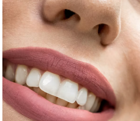 트리클로산 치약