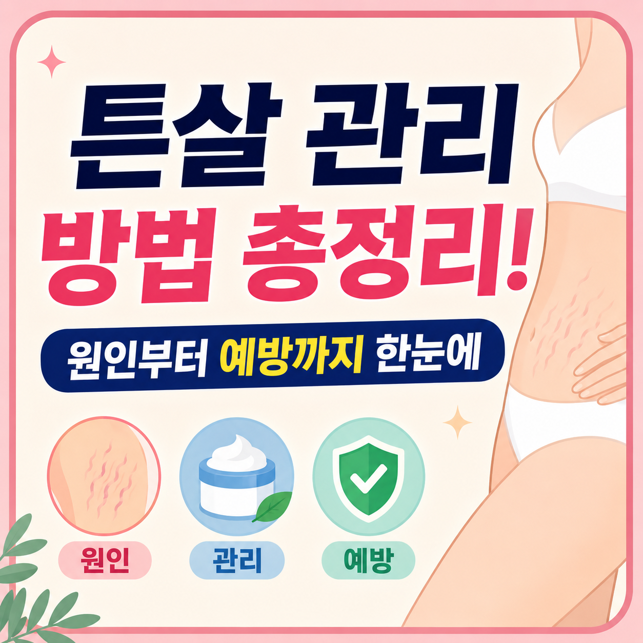튼살 관리 방법