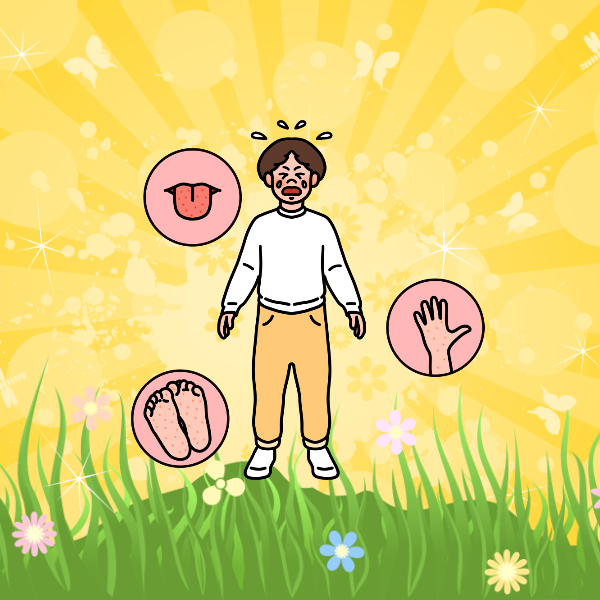 수족구증상, 수족구대처법