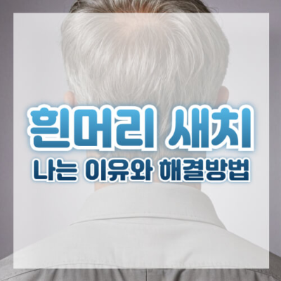 흰머리
흰머리 나는 이유
흰머리 관리
흰머리 예방
흰머리 검은 머리로 되돌리는 법
흰머리 원인
흰머리 안나게 하는 법
흰머리 뽑으면 안 되는 이유
흰머리 해결 방법
흰머리 자연 치료
흰머리 염색 없이 관리
아mla 오일 효능 (인디언 구스베리)
흰머리 두피 마사지
스트레스와 흰머리 관계
멜라닌 색소 생성 방법