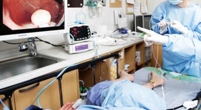 대장내시경이미지