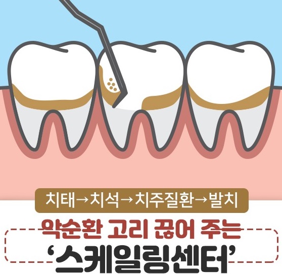 스케일링을 해야하는 이유