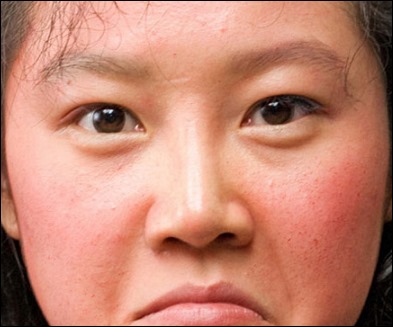 얼굴이 가려운 이유-8