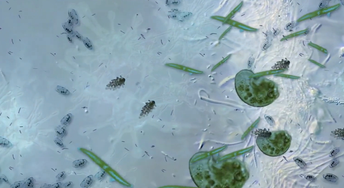 장누수증후군 증상