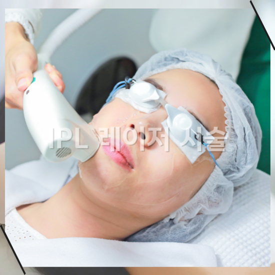 IPL 레이저 시술, 가격부터 효과·부작용 유지기간