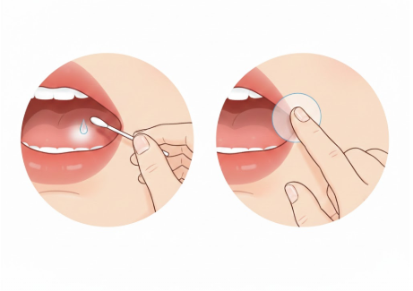 구내염 관련 사진
