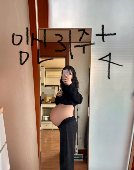 쌍둥이 임신 31주차