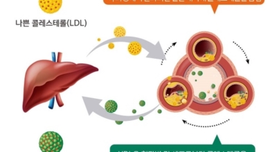 콜레스테롤 이미지