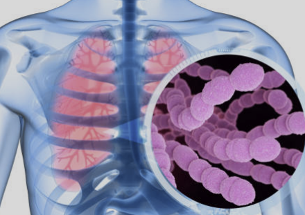 폐렴구균 예방접종 무료 시기