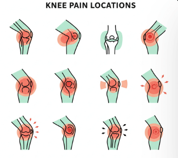 슬개골 연골연화증 증상 및 치료 방법 2