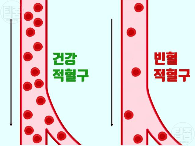 흑염소 효능 부작용 염소탕 효능 여성 빈혈