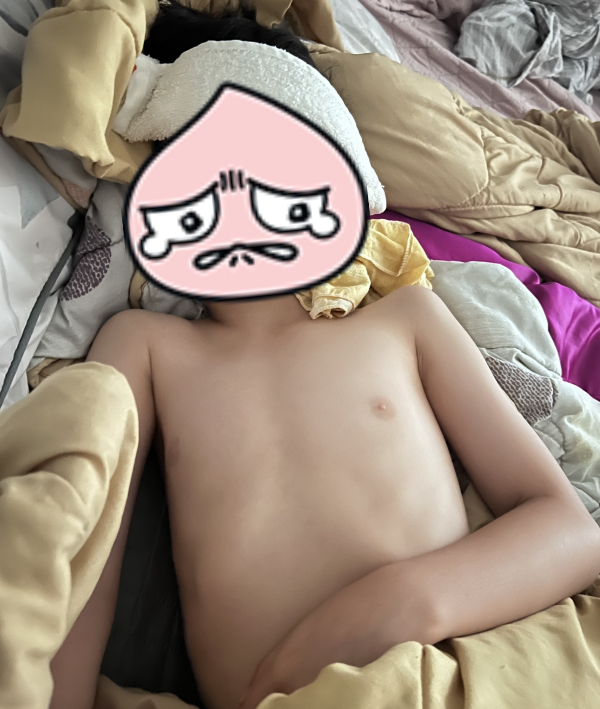 고열로 머리에 물수건을 올린 아이