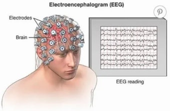 뇌의 전기 에너지
