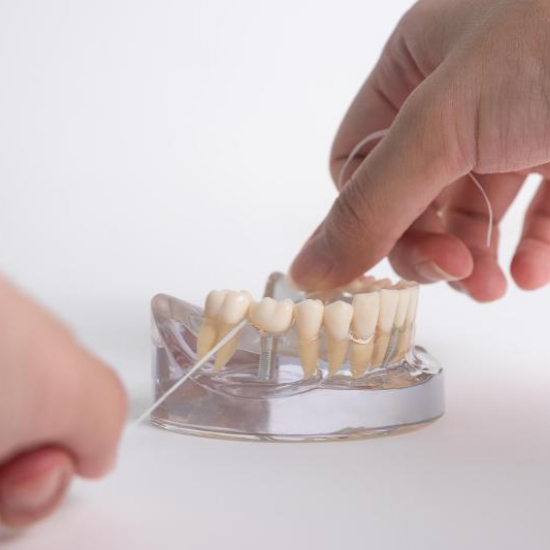 임플란트 시술과정 단계별 설명9