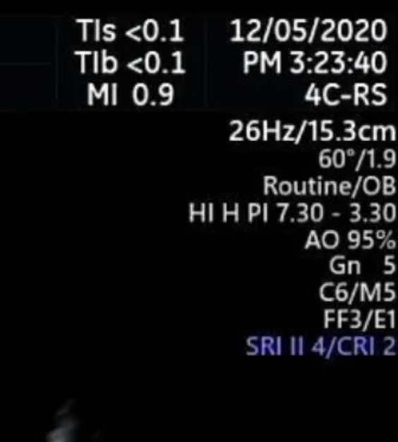 초음파 메타데이터