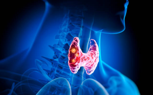 갑상선 기능 항진증 증상, 수치, 검사 총정리 (2024ver)