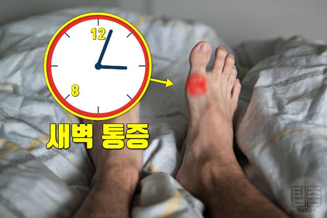 통풍 초기증상 엄지발가락 통증 원인 통풍 증상 새벽 밤