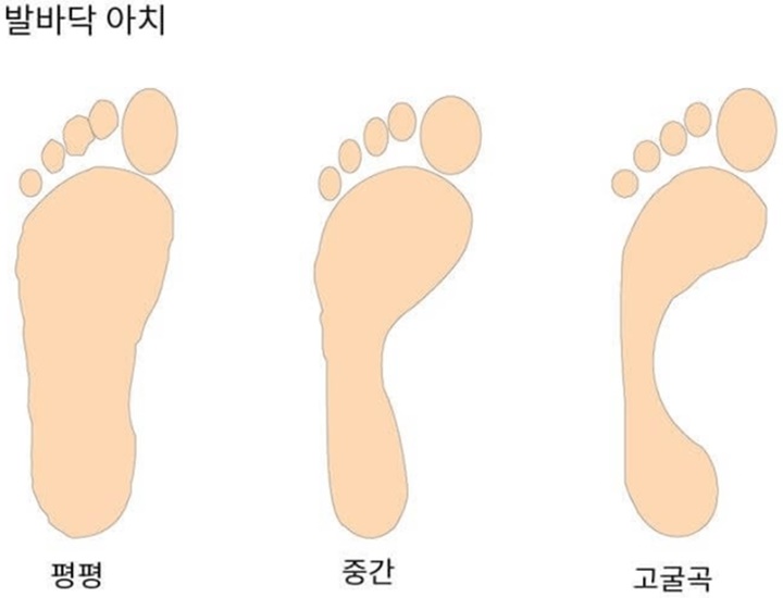 발바닥의 아치형태에 따른 발모양을 보여주는 사진
발바닥의 평평한지 굴곡이 심한지