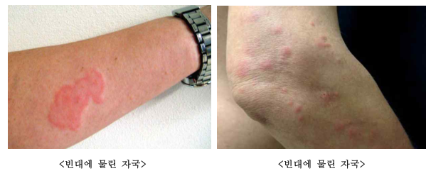 빈대 퇴치방법, 대응방안