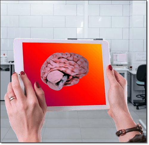 뇌기능에 좋은 트레온산 마그네슘