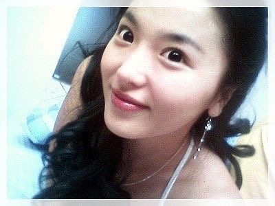 홍진영 성형 인정