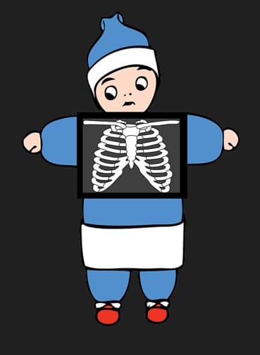 흉부엑스레이촬영중인남자