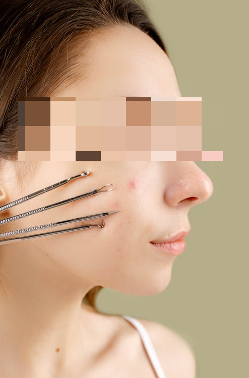 모공 관리 가이드