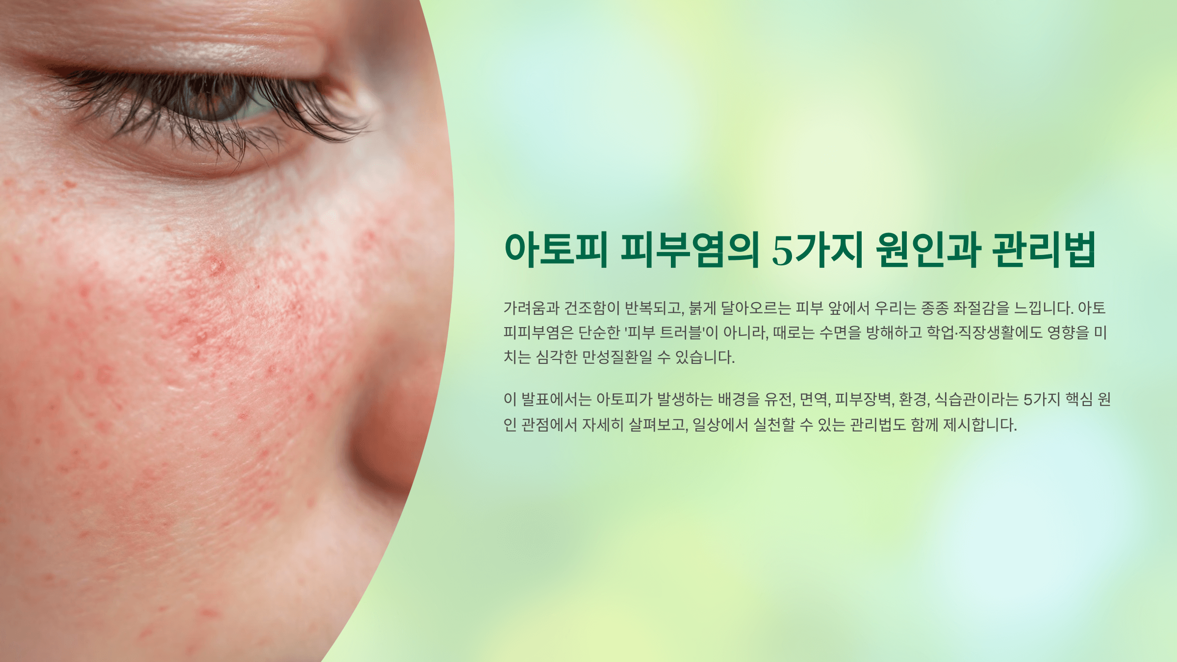 아토피 피부염 원인