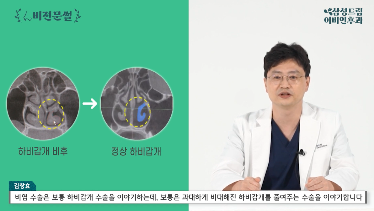 하비갑개 수술 종류
