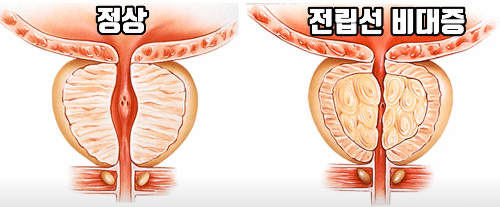 중성화수술
