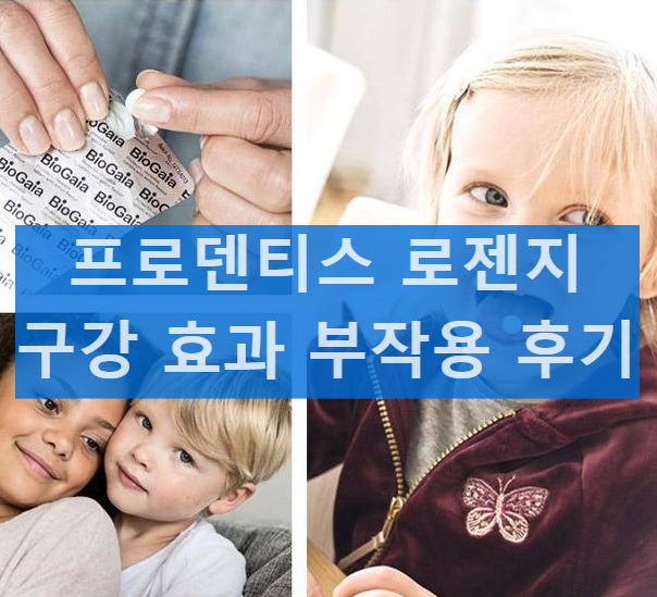 프로덴티스 로젠지 효과 부작용 가격 후기