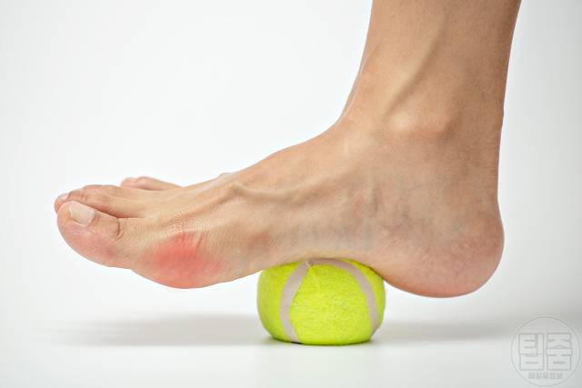 엄지발가락 옆 통증 건막류 치료 엄지발가락 휘어짐 물리치료