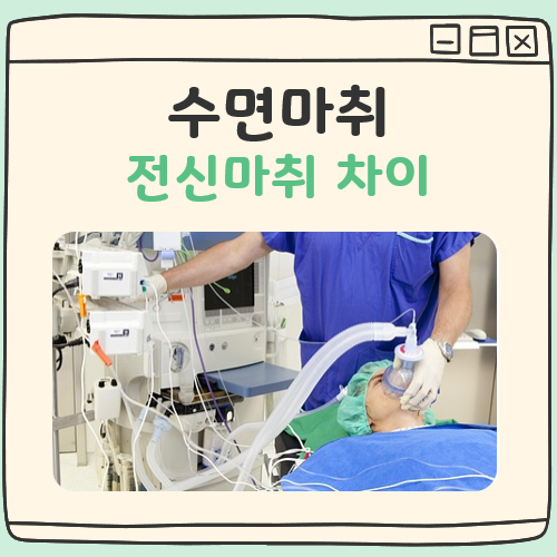수면마취 전신마취 차이 대표 이미지
