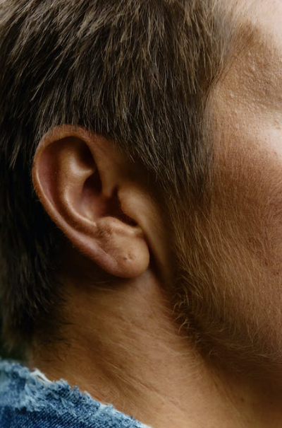 돌발성난청-치료