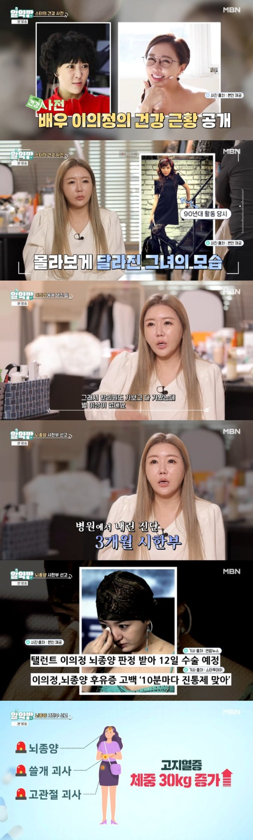 이의정 건강