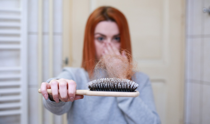 여성 탈모 관리법