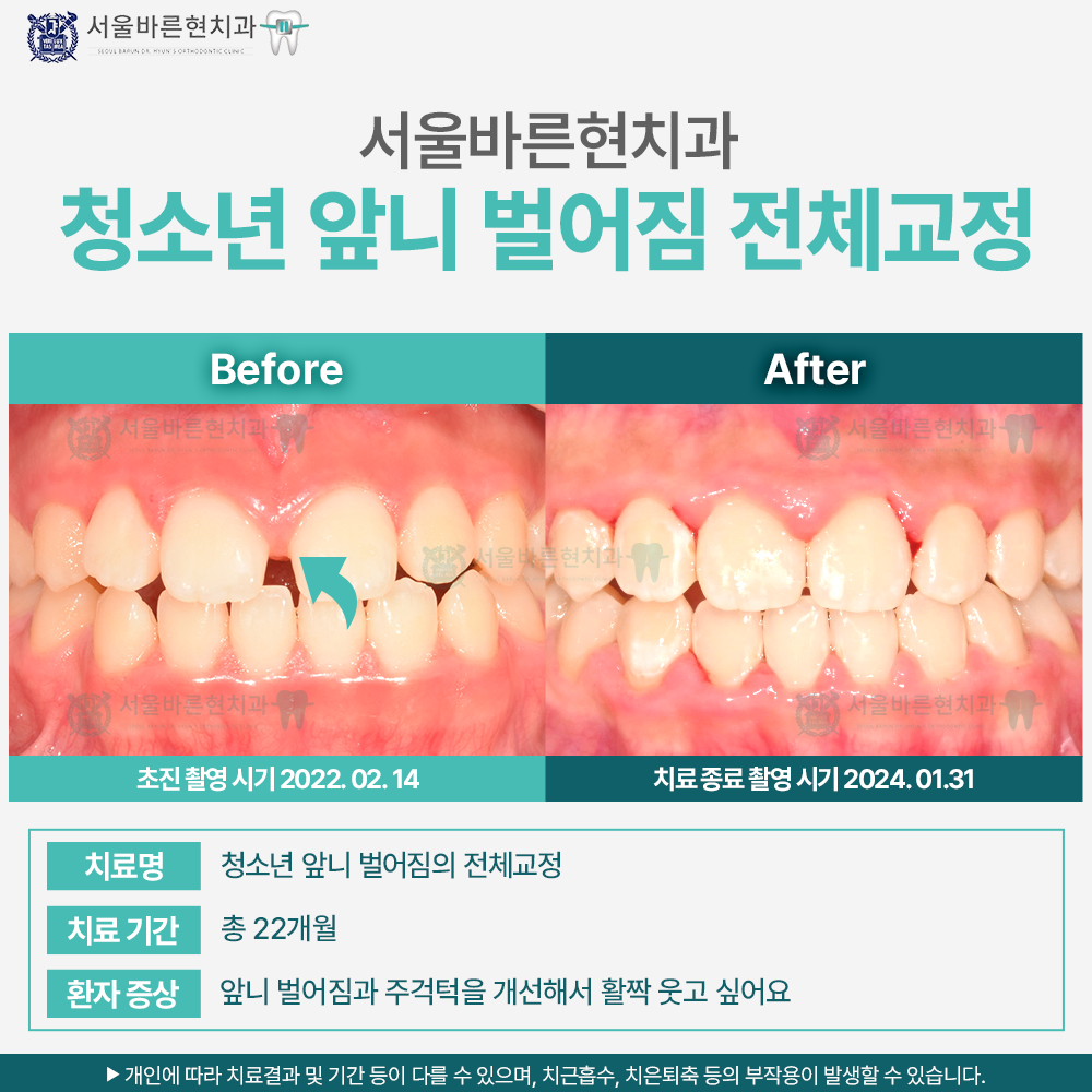 부산교정치과