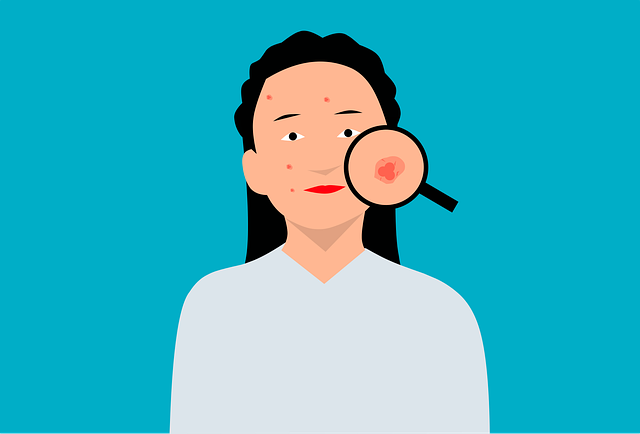 돋보기로-여성의-얼굴에-발생한-여드름을-확대하고-있습니다.