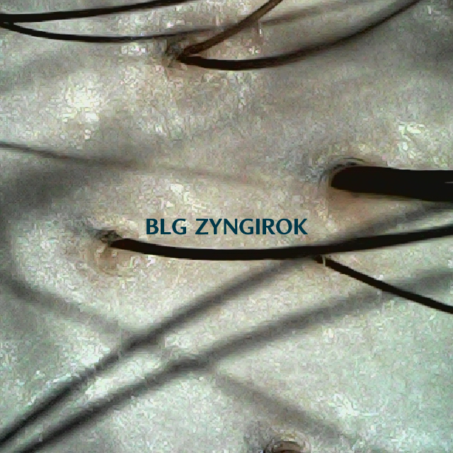 피나모아 복용 19주차 - 정수리와 이마사이 두피 모습이다.