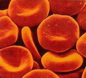 Ferritin 수치