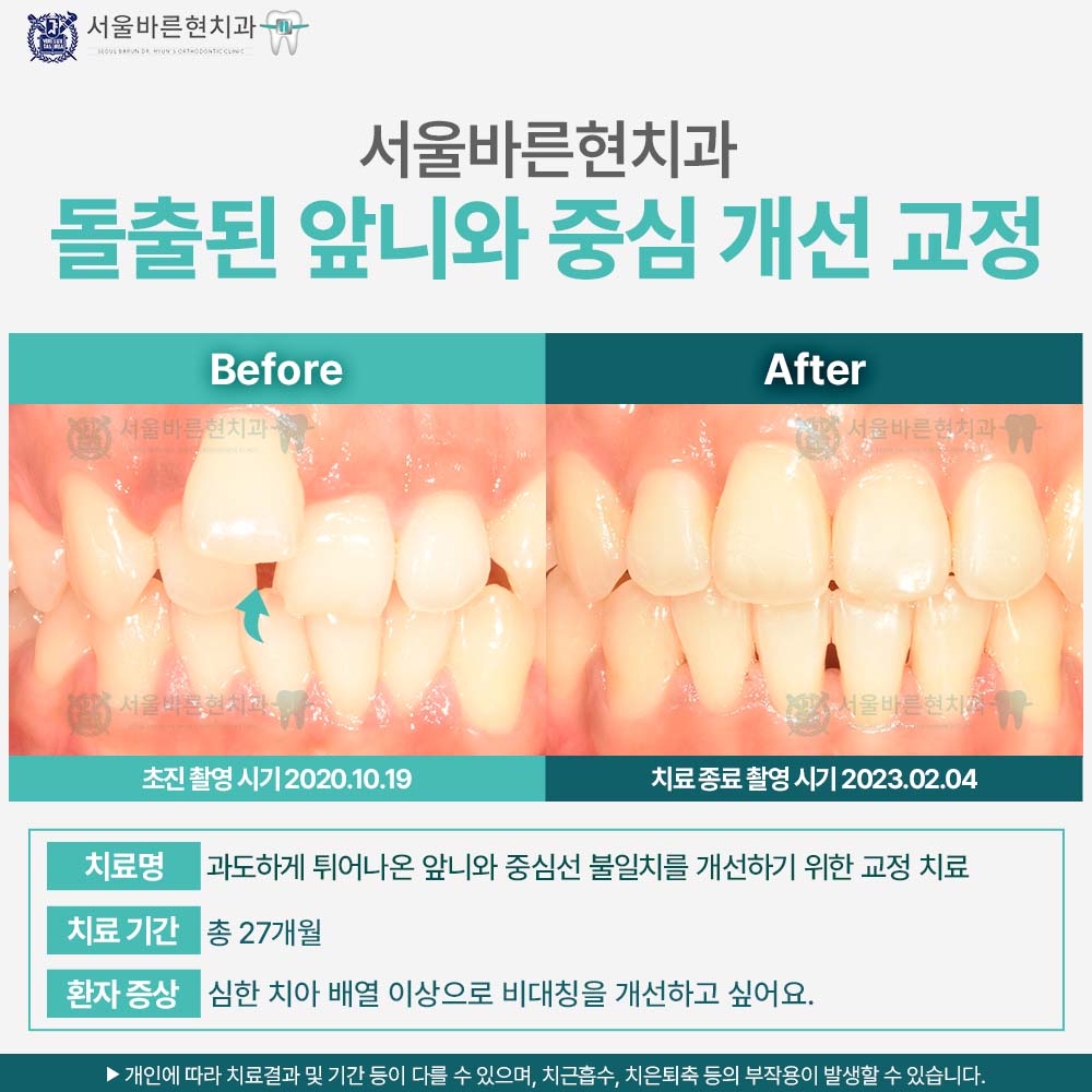 해운대교정치과