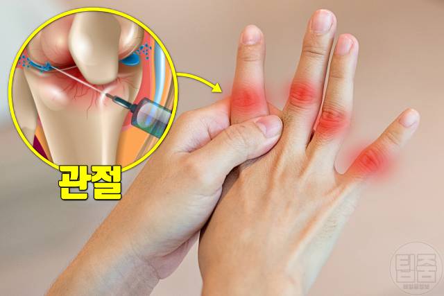 손발 붓기 생기는 이유 원인