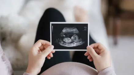 비타민d 효능 28