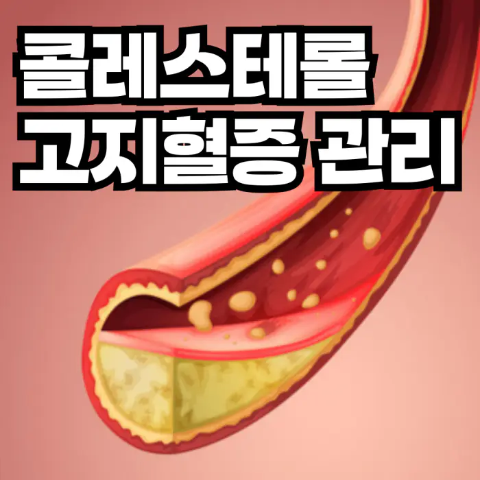 1.콜레스테롤(1)