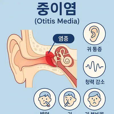 중이염 증상 체크리스트와 원인별 예방법 완벽 가이드